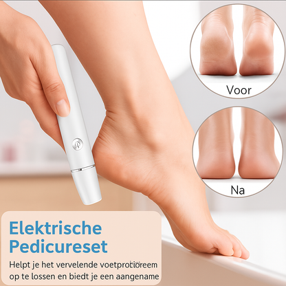 Elektrische Eelt-verwijderaar