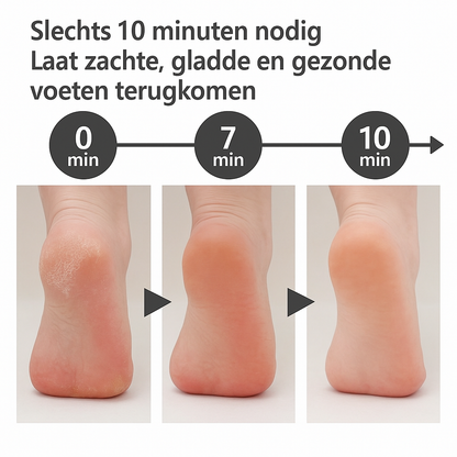 Elektrische Eelt-verwijderaar