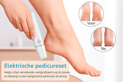 Elektrische Eelt-verwijderaar